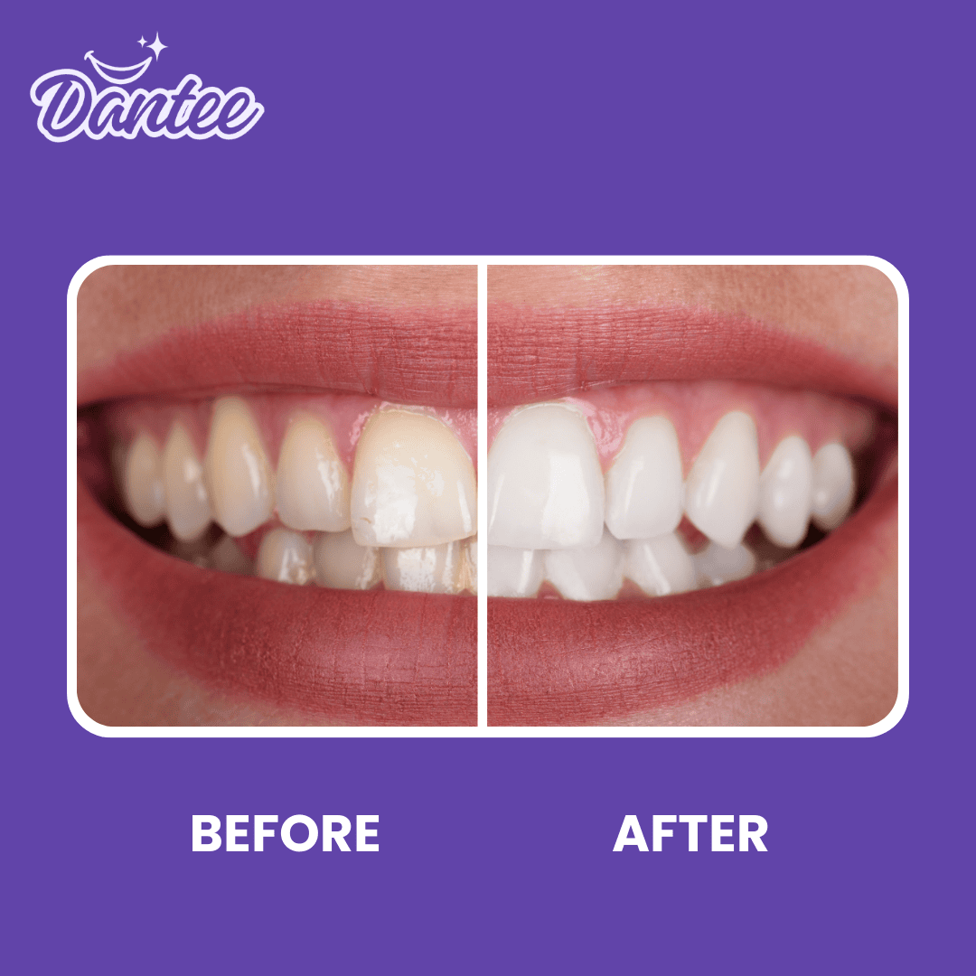Teeth Color Corrector - Image 3